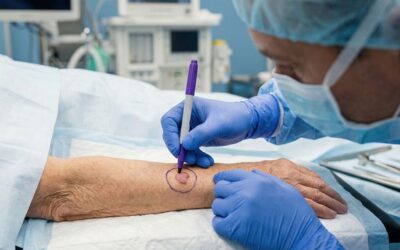 Est-il urgent d’enlever un carcinome basocellulaire ?